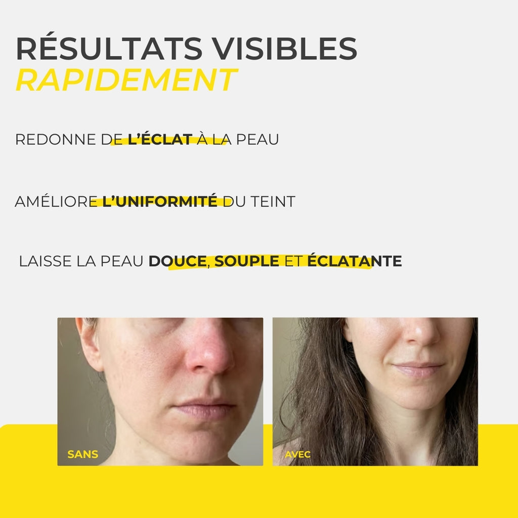 Masque visage — aide ta peau à se rééquilibrer face au stress en 10 minutes